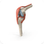 Bone Disorders