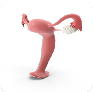 WOMEN'S HEALTH